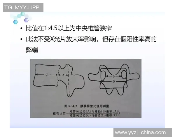 重庆乒乓球队区域防守策略解析及其在比赛中的应用探讨